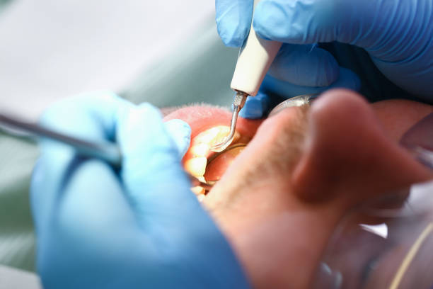 Best Emergency Orthodontic Repairs in Union Park, FL
