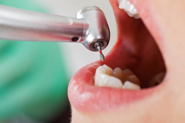 Best Emergency Treatment for Toothache in Union Park, FL
